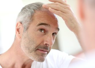 mature hairline