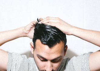 hair loss